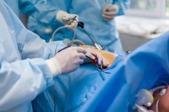Σε προχωρημένο στάδιο οστεοχονδρωσίας της οσφυϊκής μοίρας της σπονδυλικής στήλης είναι απαραίτητη η χειρουργική επέμβαση